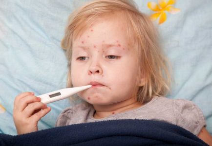 11 copii bolnavi cu rujeolă, în Neamț, ZCH NEWS - sursa ta de informații