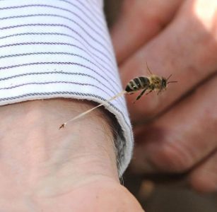 Șoc anafilactic de la o înțepătură de viespe, ZCH NEWS - sursa ta de informații