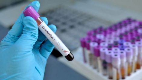 Media de 200 noi infectări COVID 19 în Neamţ se menţine, ZCH NEWS - sursa ta de informații