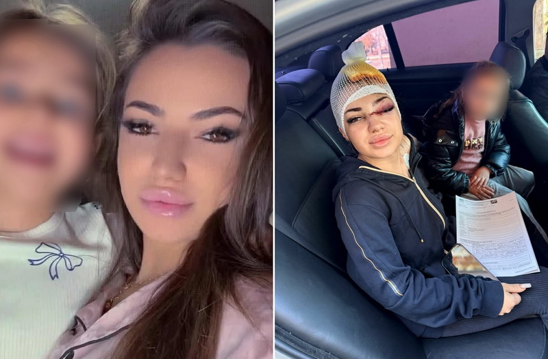 Neamț: Tânără bătută crunt în urma unui conflict pornit din gelozie